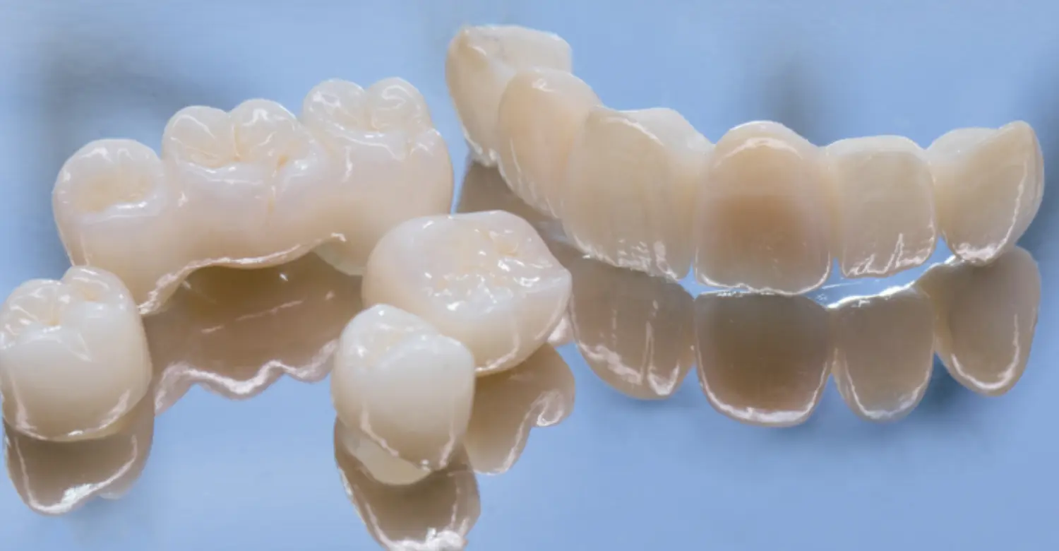 Zirconia Dental Restorations 2